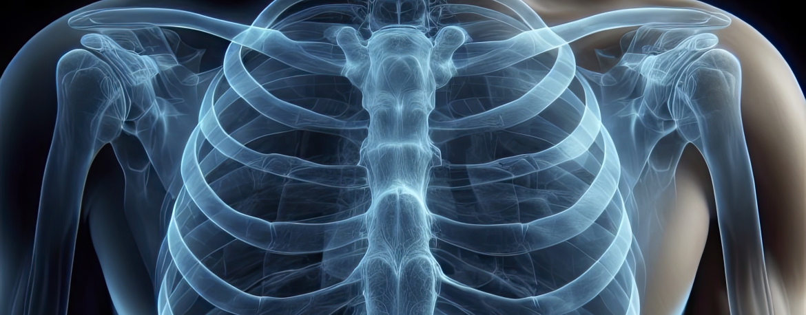 Oncología Toráxica - Manejo interdisciplinario del cáncer de pulmón localizado